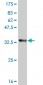 ATOX1 Antibody (monoclonal) (M08)